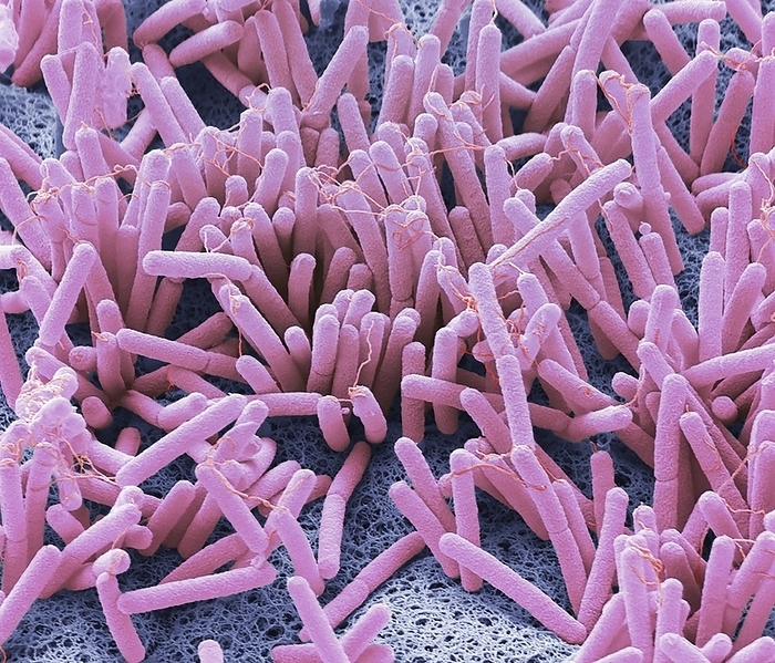 Penile bacteria, SEM Bacteria from a penis. Coloured scanning electron micrograph of bacteria from an uncircumcised penis. The skin of the penis is home to a diverse community of bacteria. Genetic tests to identify the bacteria found on men s penises showed there were a total of 42 unique kinds of bacteria inhabiting the skin. Studies have shown uncircumcised and circumcised penises don t have the same variety and abundance of bacteria. After circumcision, there were fewer kinds of bacteria on mens penises. Many of the kinds of bacteria found to be less common or absent after circumcision were anaerobic  don t need oxygen to grow . Circumcision has been linked to a lower risk of contracting HIV  human immunodeficiency virus . One theory is the anaerobic bacteria may prompt the immune system to respond in a way that makes cells more vulnerable to HIV infection. Magnification: x6600 when printed at 10 centimetres wide.