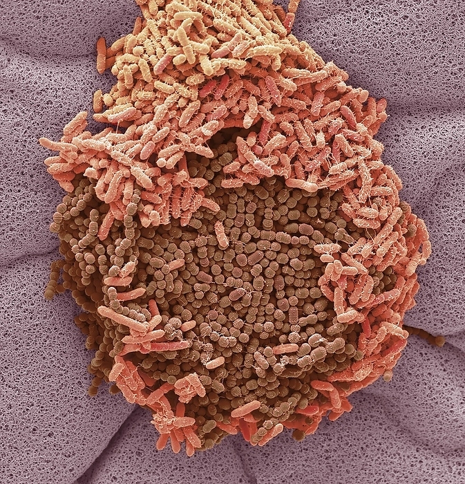 Faecal bacteria, SEM Faecal bacteria. Scanning electron micrograph  SEM  of bacteria cultured from a sample of human faeces. At least 50 per cent of human faeces is made up of bacteria shed from the gut. Many of these bacteria are a normal part of the flora found in the intestines and are beneficial to digestion. However, some are pathogenic, such as Salmonella enterica and certain strains of Escherichia coli, which can cause foodborne illnesses. Magnification: x25000 when printed 10 centimetres wide.