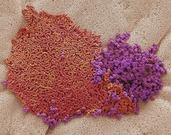 Foot bacteria, SEM Foot bacteria. Scanning electron micrograph  SEM  of bacteria that live on human feet. Such bacteria metabolise sweat and other substances on the skin. Brevibacterium sp.  red  are considered a major cause of foot and shoe odour because they ingest dead skin on the feet and, in the process, convert the amino acid methionine into methanethiol, a colourless gas with a distinctive putrid smell that has a sulfuric aroma. The dead skin that fuels this process is especially common on the soles and between the toes. Brevibacterium also give cheeses their characteristic smell. Magnification: x15000 when printed 10 centimetres wide.