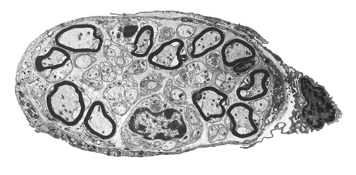 Peripheral nerve, TEM Peripheral nerve. Black and white transmission electron micrograph  TEM  of a section through a small peripheral nerve. Myelin  dark rings  is an insulating fatty layer that surrounds the myelinated nerve fibres, increasing the speed at which nerve impulses travel. It is formed when Schwann cells wrap around the fibre, depositing layers of myelin between each coil. An outer sheath or perineurium surrounds the connective tissue endoneurium that in turn surrounds the nerve fibres and Schwann cells. Magnification: x1500, when printed 10 centimetres wide., by STEVE GSCHMEISSNER SCIENCE PHOTO LIBRARY