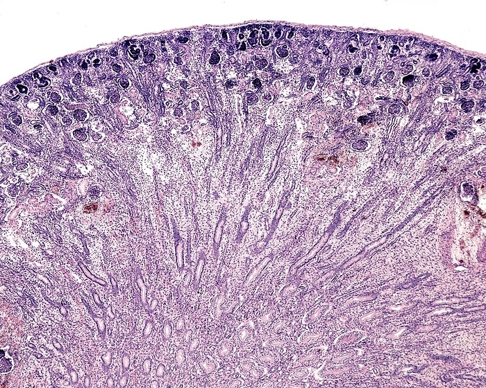 Developing kidney, light micrograph Kidney lobule of a 20 weeks foetus showing a cortex and medulla well defined. The nephrogenic zone can be seen at the periphery of the cortex as a basophilic band. Developing glomeruli can be recognized under the nephrogenic zone. Magnification: x36 when printed at 10 centimetres wide.