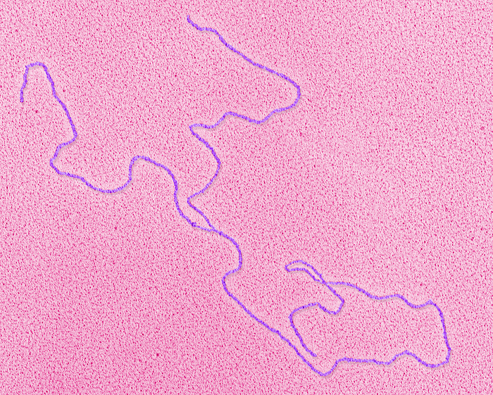 DNA replication, TEM DNA replication. Coloured transmission electron micrograph  TEM  of a molecule of DNA  deoxyribonucleic acid  replicating. DNA is composed of two strands twisted into a double helix. Before replication the strands separate from each other  as seen here , forming a replication fork. Each strand then acts as a template for the formation of a new DNA molecule. This is known as semi conservative replication as each new molecule retains a strand from the parent molecule.