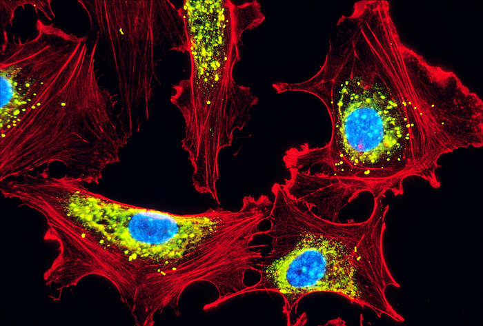 Human endothelial cells, light micrograph Human endothelial cells. Light micrograph of cultured human endothelial cells, a cell type found lining the blood vessels. Fluorescent dyes have been used to show the cell structures. Actin filaments are red, the cell nuclei are blue, and microcorpuscules containing Von Willebrand factor are yellow. Actin is the most abundant cellular protein, forming part of the cells  cytoskeleton, the system that is responsible for intracellular transport, and the structure and motility of the cells. The cell nuclei contain the cells  genetic information, DNA  deoxyribonucleic acid , packaged in chromosomes. Von Willebrand factor is a blood clotting protein. Magnification: x350 when printed at 10 centimetres wide.