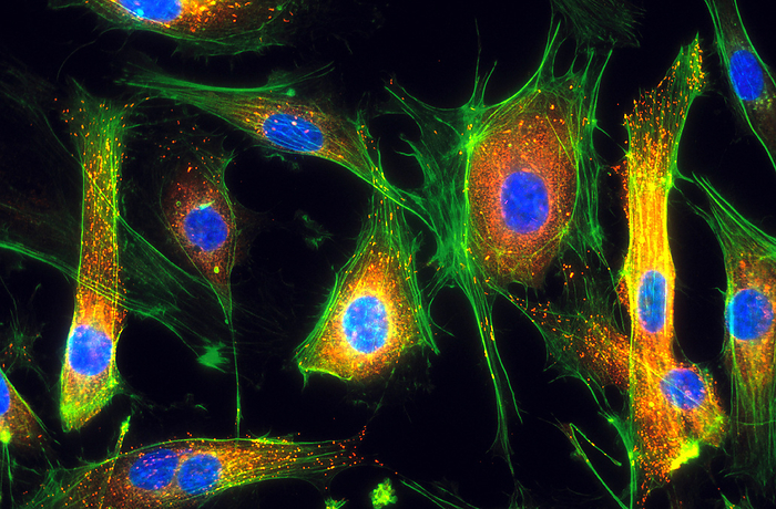 Human endothelial cells, light micrograph Human endothelial cells. Light micrograph of cultured human endothelial cells, a cell type found lining the blood vessels. Fluorescent dyes have been used to show the cell structures. Actin filaments are green, the cell nuclei are blue, and microcorpuscules containing Von Willebrand factor are orange. Actin is the most abundant cellular protein, forming part of the cells  cytoskeleton, the system that is responsible for intracellular transport, and the structure and motility of the cells. The cell nuclei contain the cells  genetic information, DNA  deoxyribonucleic acid , packaged in chromosomes. Von Willebrand factor is a blood clotting protein. Magnification: x200 when printed at 10 centimetres wide.