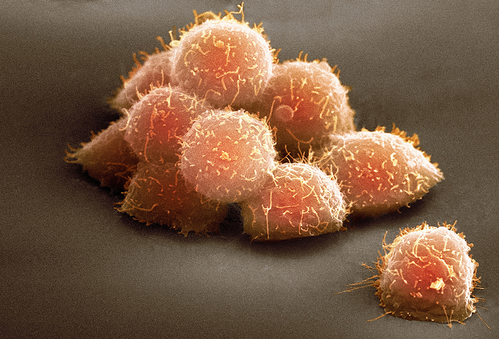 Stem cells, SEM Stem cells, coloured scanning electron micrograph  SEM . Stem cells can differentiate into any other cell type. There are three main types of mammalian stem cell: embryonic stem cells, derived from blastocysts  adult stem cells, which are found in some adult tissues  and cord blood stem cells, which are found in the umbilical cord. The cells seen here are destined to become blood cells. During blood cell development in adults, stem cells develop through a process known as haemopoiesis. Blood cells have short lifespans and are therefore constantly produced by the bone marrow.