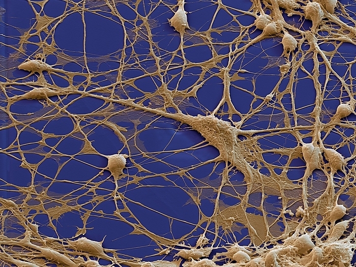 Neural progenitor cells, SEM Human neural progenitor cells in a culture medium, coloured scanning electron micrograph  SEM . Neural progenitor cells are between stem cells and fully differentiated cells. They can not, like stem cells, develop into any cell  multipotentency  but may develop into different sorts of neural cell  neurons, astrocytes or oligodendrocytes . Magnification: x1040 when printed 10 centimetres wide.