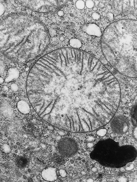 Mitochondria in cross section Transmission electron micrograph of mammalian mitochondria in cross section. Mitochondria are the sites of cell respiration   the chemical process which uses molecular oxygen to oxidise sugars   fats in order to produce energy. The energy is stored as adenosine triphosphate or ATP   is used by the cell to drive chemical reactions such as protein formation. Mitochondria are bound by a double membrane. The inner membrane is folded to produce ingrowths   seen here  called cristae, which are where the chemical reactions of respiration occur. Other cellular organelles are visible in the surrounding cytoplasm. Mag: x70,000 at 10x8 inch size, x9,100 at 35mm size.