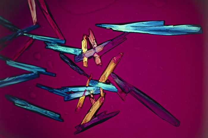 Light micrograph of glucose crystals, x80 Glucose. Polarised light micrograph of crystals of glucose sugar. Magnification: x80 at 35mm size. deep red.