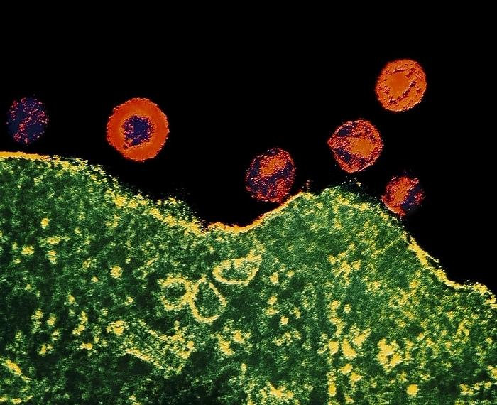 TEM of AIDS virus particles False colour transmission electron micrograph  TEM  showing AIDS virus particles  orange and blue  above the surface of an infected T4 lymphocyte, a white blood cell. Two forms of the AIDS virus are now recognized  1988 , designated human immunodeficiency virus types 1 and 2  HIV 1 and  2 . HIV 1 is seen here. At centre left is a newly released virus particle  virion , with a group of mature virions to the right. Infection with HIV depletes the population of T4 cells and thus disables the immune system, rendering its victim liable to a number of fatal diseases. Magnification: x30,500 at 6c6cm size, x20,000 at 35mm size. JBU colouring. BW original is M050 118.