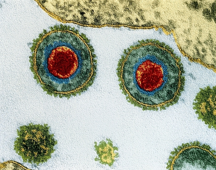 Coloured TEM of herpes simplex viruses Herpes simplex viruses. Coloured Transmission Electron Micrograph  TEM  of a section through herpes simplex virus particles. A core of red genetic material is seen enclosed within an outer protein coat. The viruses are at the surface of an infected cell  light yellow, top right . Herpes simplex exists in two general forms: type I is associated with oral cold sore infections, and type II with genital herpes infections. Herpes simplex is one of the most common viral parasites in humans. They cause small, fluid filled blisters which, if touched, can spread the virus. The blisters occur on the mouth or genitalia. Magnification: x120,000 at 6x7cm size.