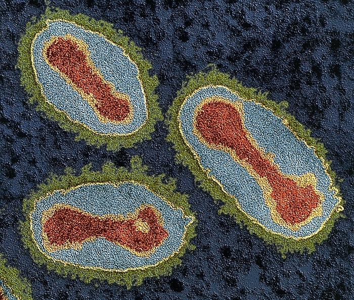 Smallpox viruses Smallpox viruses. Coloured transmission electron micrograph  TEM  of a section through Variola viruses, the cause of smallpox. Variola belongs to the orthopoxvirus group of viruses. The virus has a protein coat  capsid, green  surrounding its DNA  deoxyribonucleic acid, red  genetic material. Smallpox was eradicated from the world by a global vaccination in the 1970s. Isolated cultures of Variola viruses are still kept in laboratories for research purposes. The disease causes high fever and skin spots that quickly develop into scarring pustules. The virus is transmitted by coughed droplets or the pus from pustules of an infected person. Magnification: x120,000 at 6x7cm size.