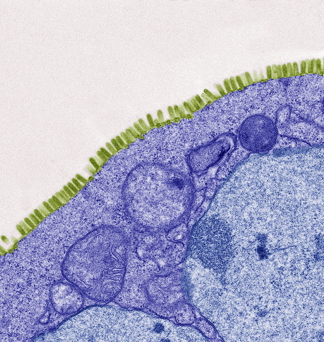Vesicular stomatitis virus, TEM Vesicular stomatitis virus. Coloured transmission electron micrograph  TEM  of vesicular stomatitis virus  VSV  particles  green  budding from a host cell  blue . Viruses replicate using the host cell s genetic machinery. These virus particles have formed in a cultured cell. VSV is a disease that infects sheep, horses and goats, and is similar to foot and mouth disease.