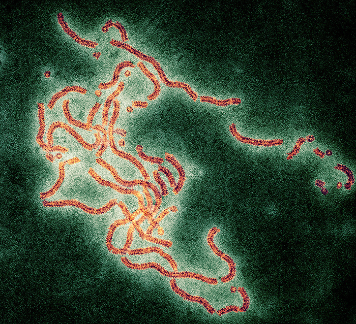 Mumps virus, TEM Mumps virus. Coloured transmission electron micrograph  TEM  of mumps virus ribonuclear protein helices  red strands  replicating within a host cell. These helices contain the genetic material ribonucleic acid  RNA  in combination with protein. A viral particle contains a single ribonuclear protein helix enclosed in a spherical protein shell, or capsid. Mumps virus is a contagious paramyxovirus, causing swelling of the parotid salivary glands, fever, headache and vomiting. Infection can spread to the pancreas, brain and testicles. In adult males, infection can cause sterility. Magnification: x120,000 when printed 10 centimetres wide.