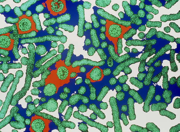 Hepatitis B viruses Hepatitis B viruses. Coloured transmission elect  ron micrograph  TEM  of hepatitis B viruses  large green circles , a cause of liver inflammation. The smaller circles and the rod shaped objects are surplus viral coat  capsid  protein from infected liver cells. These non infectious antigens  foreign proteins  are used to make vaccines against hepatitis B. The complete viruses are called Dane particles. Hepatitis B is transmitted by infected blood passed mainly through sexual intercourse or the sharing of needles by intraven  ous drug users. Symptoms include headache, fever, weakness and jaundice. Magnification unknown.