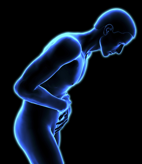 Abdominal pain Abdominal pain. Computer artwork of a man suffering abdominal pain.