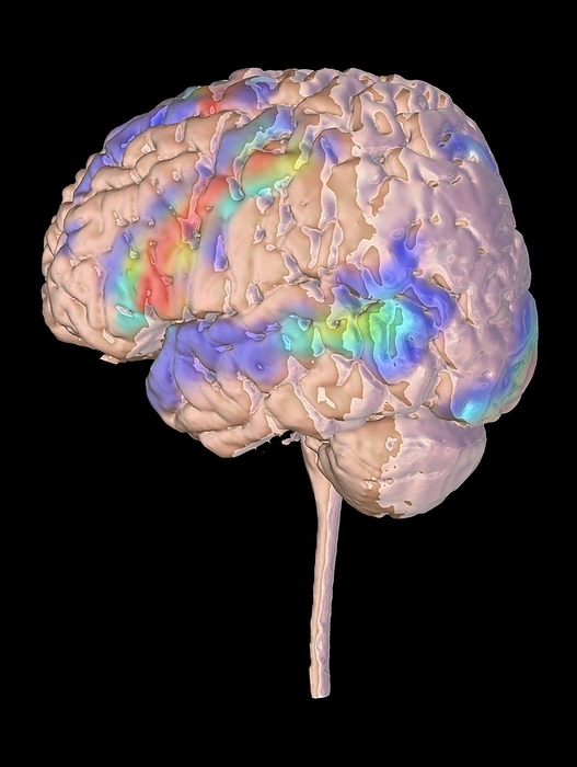 Brain activity during a visual language task, fMRI scan Composite image of the results of a functional magnetic resonance imaging  fMRI  scan overlaid on a model of the brain. fMRI studies show areas of the brain with increased activity during particular tasks. This scan shows the results of a visual sentence completion task, which activated Broca s area in the left frontal  left  lobe and Wernicke s area in the left temporal lobe. Broca s area is linked to speech production, while Wernicke s area is involved in the comprehension of written and spoken language. Areas of the visual cortex at the rear  right  of the brain are also activated., by K H FUNG SCIENCE PHOTO LIBRARY