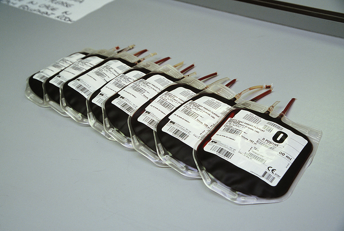 Intermediate blood mixtures Intermediate blood mixtures. Bags of blood pooled using components of donor blood, a process called component pooling. Donor blood is separated into its component parts for more efficient use of the blood. These components are mixed back together to produce the required blood. This blood is labelled as having red blood cells from group O  universal donor blood group  and it is depleted of platelets  needed for clotting . It also has the Rh  rhesus  D antigen and is labelled D positive. Buffy coat refers to the white blood cells  lymphocytes . The blood mix displayed here is not yet suitable for clinical use. It is an intermediate product that needs to have more blood components added.