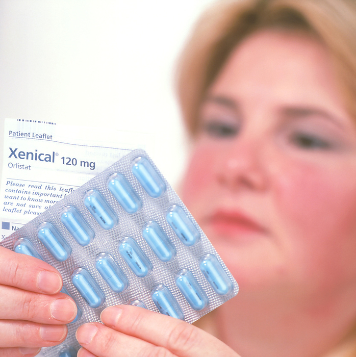 Obese woman holds Xenical weight loss drug Xenical anti obesity drug. Obese woman holds a bubble pack of Xenical  orlistat  anti obesity capsules, for use in weight loss. Released in the USA in 1998, it is a non systemic lipase inhibitor drug or fat blocker. Unlike many other diet drugs, this drug does not achieve its effect by acting on the brain. It acts on the gastro intestinal tract to prevent the absorption of fat by about 30 percent. In a one year clinical trial, the average patient weighing 220 pounds lost 20 pounds  10  body weight  taking Xenical on a moderately reduced calorie diet. Xenical also reduces LDL cholesterol in the blood. Obese people weigh 20  or more of their desirable body weight.