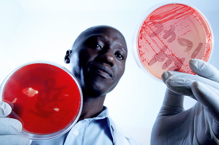 Staphylococcus bacteria research MODEL RELEASED. Staphylococcus bacteria research. Bacteriologist holding petri dishes containing Staphylococcus sp. bacteria. This bacterium is usually harmless as it is found naturally on the skin and mucous membranes of humans and many animals. However, it can cause infections if it comes into contact with broken skin and can cause food poisoning if ingested. Some strains have also developed wide ranging antibiotic resistance, such as methicillin resistant S. aureus  MRSA . MRSA is a dangerous hospital pathogen, as it can infect post surgery wounds and cause pneumonia to develop in those with weakened immune systems. Photographed at St. Mary s Hospital in Lacor, Gulu, Uganda.