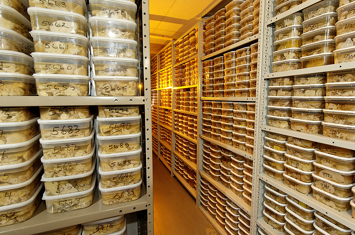 Brain Bank Brain bank. Human brain sections stored at the Harvard Brain and Tissue Resource Centre, USA. The brains are preserved in formalin and kept in plastic tubs. This is the largest brain bank in the world. It stores over 3,000 healthy and diseased brains for medical research into diseases such as Parkinson s, Alzheimer s and schizophrenia.
