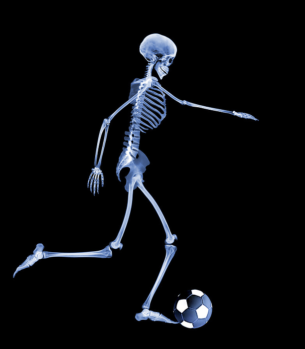 Skeleton playing football Skeleton playing football. Computer enhanced X  ray of a skeleton kicking a football.