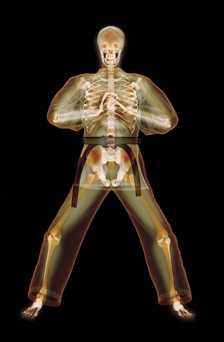 Martial arts greeting, X ray artwork Martial arts greeting. Enhanced X ray of a man performing a kung fu greeting.