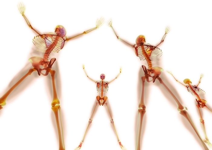 Star jumps, X ray artwork Star jumps. Enhanced X ray of a group of people performing star jumps.