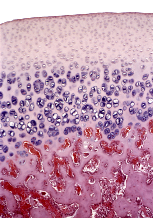 Bone growth, light micrograph Bone growth. Light micrograph of actively growing cells in the epiphyseal plate  growth plate  between the diaphysis  shaft  and epiphysis  rounded end  of a long bone. Seen at top  pale  is a region of hyaline cartilage cells  chondrocytes  that divide, enlarge and eventually die. The proliferation of these cells is seen at centre  purple . The cartilage matrix is replaced with bone formed from osteoblast cells, which results in a calcified matrix  seen here at bottom, pink . This process is known as ossification and it serves to increase the length of the diaphysis of long bones.