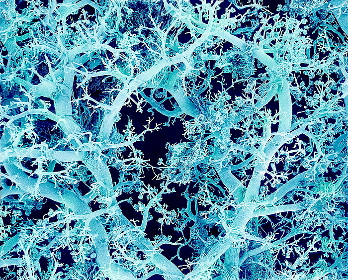 Blood vessels, SEM Blood vessels. Coloured scanning electron micrograph  SEM  of a resin cast of blood vessels in the kidney. This network of vessels infiltrates the tissue, supplying it with blood. Gases and nutrients are exchanged between the blood and surrounding tissue through the permeable walls of capillaries, the smallest blood vessels. The kidneys are responsible for the selective removal of nitrogenous waste from the blood. This cast was made by injecting resin into the blood vessels. The surrounding tissues were then chemically digested. Magnification: x30 at 6x7cm size.