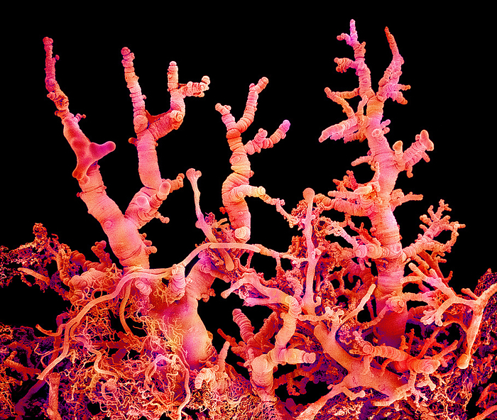 Blood vessels in a lung, SEM Blood vessels in a lung, coloured scanning electron micrograph  SEM  of a resin cast. The lungs facilitate gaseous exchange of oxygen from the air breathed into the lungs with carbon dioxide formed by cell respiration. The fine network of smaller vessels seen branching off from the main vessel infiltrate the tissue, supplying it with blood. Gases and nutrients are exchanged between the blood and the surrounding tissues through the permeable walls of capillaries, the smallest of blood vessels. The cast was made by injecting resin into the blood vessels, followed by chemical digestion of the surrounding tissues. Magnification: x8 at 6x7cm size.