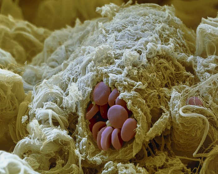 Capillary, SEM Capillary. Coloured scanning electron micrograph  SEM  of a section through a human capillary, showing the red blood cells  red discs  it contains. The capillaries are the smallest type of blood vessel. They infiltrate body tissues, forming a fine network that links veins and arteries. They have permeable walls that allow the exchange of gases and nutrients between the blood and the tissues. Red blood cells, also known as erythrocytes, transport oxygen to the tissues and carbon dioxide back to the lungs. Magnification: x1640 at 6x7cm size. x2600 at 5x4 inch size.