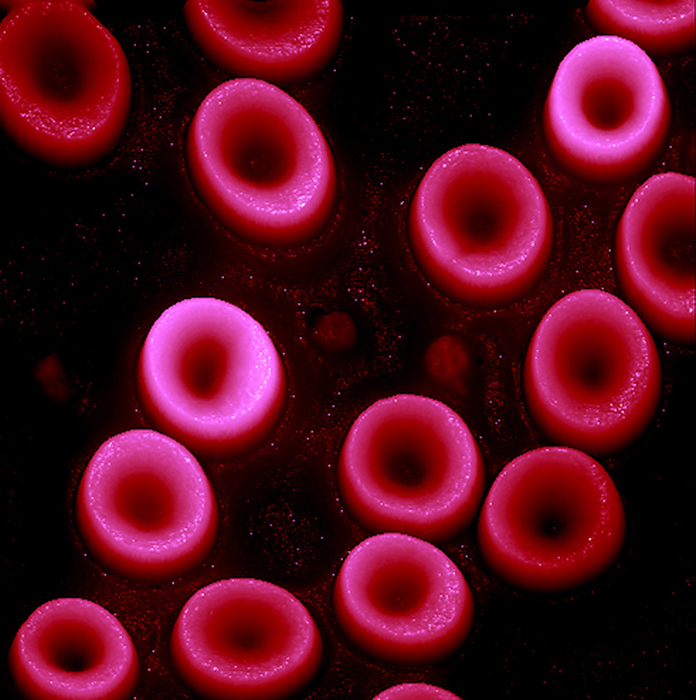 Red blood cells, AFM Red blood cells. Coloured atomic force micrograph  AFM  of erythrocytes  red blood cells . Red blood cells are biconcave, giving them a large surface area for gas exchange, and highly elastic, enabling them to pass through narrow capillary vessels. The nucleus and other organelles are lost as the cells mature. The cell s interior is packed with haemoglobin, a red iron containing pigment that has an oxygen carrying capacity. The main function of red blood cells is to distribute oxygen to body tissues and to carry waste carbon dioxide back to the lungs. Magnification: x3300 when printed at 10 centimetres wide.