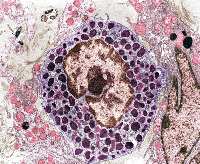 Mast cell, TEM Mast cell, coloured transmission electron micrograph  TEM . Mast cells  mastocytes  are a type of white blood cell  leukocyte  found in connective tissue. The large oval  pink and brown  is the cell s nucleus, which contains its genetic information. Within the cell s cytoplasm  purple  are granules  dark purple  containing chemical mediators, including histamine and heparin. When the mast cell is activated, either by an allergic reaction or in response to injury or inflammation, these granules are released into the tissues. Histamine is responsible for the symptoms of an allergic reaction, such as itching, and heparin prevents blood from clotting. Magnification: x6,700 when printed at 10 centimetres wide.