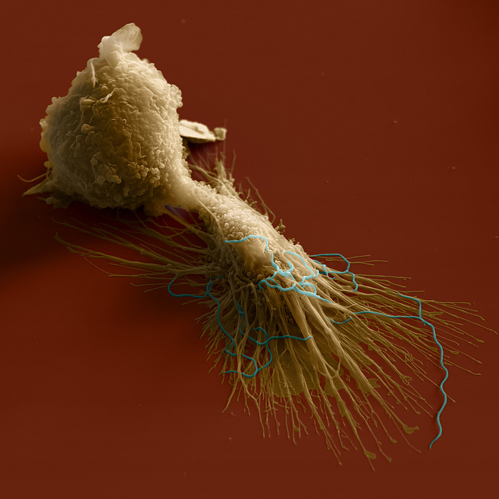 Macrophage, SEM Macrophage. Coloured scanning electron micrograph  SEM  of a macrophage  pale brown  engulfing Borrelia sp. bacteria  blue . Macrophages are scavenging white blood cells  leucocytes  present in many body tissues. As part of the body s immune response, they accumulate at sites of infection and engulf foreign invaders by a process known as phagocytosis. They also play an important role in stimulating other cells of the immune system to respond to foreign agents. Magnification :x1503 at 6x6cm size. x2400 at 4x5 inch size.