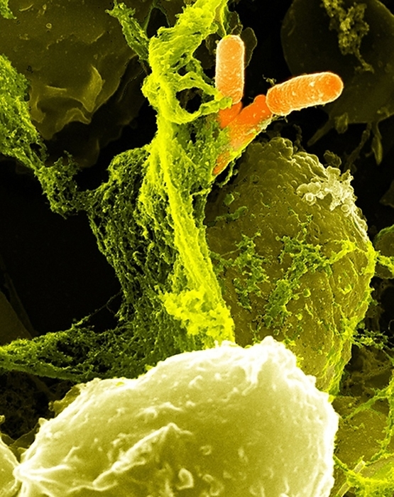 Neutrophils and Shigella bacteria, SEM Neutrophils and Shigella bacteria. Coloured scanning electron micrograph  SEM  of neutrophil white blood cells  large, yellow green  and Shigella bacteria  orange, upper right . The neutrophils, as part of the body s immune response, are extruding extracellular traps to engulf  phagocytose  and destroy the bacteria. Shigella is a Gram negative rod shaped bacterium. It infects the large intestine and causes mild to severe forms of dysentery.