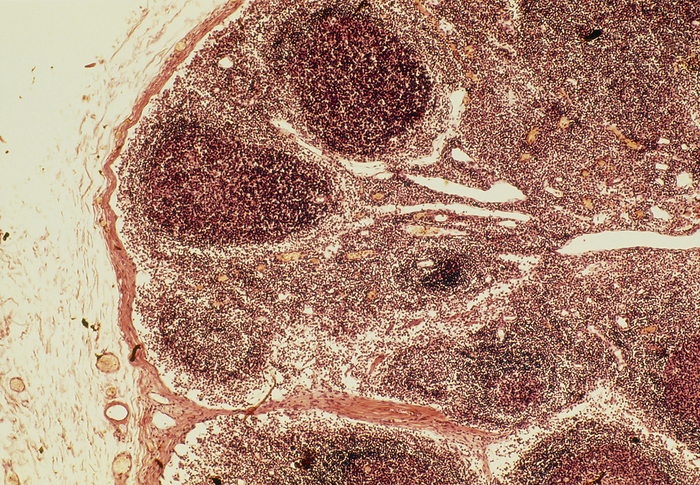 Light micrograph of a healthy human lymph node Lymph node. Light micrograph of a section through a healthy human lymph node. The follicles  oval, purple  are the regions in which B lymphocyte white blood cells proliferate. Surrounding the lymph node is a collagenous capsule  pink, at left . This supportive tissue extends into the node as a trabecula  pink . Lymph nodes are kidney shaped organs into which the fluid from body tissues drains and is filtered. The nodes are packed with white blood cells that destroy disease causing microorganisms within the fluid. The granular appearance of the tissue is caused by the presence of thousands of lymphocyte white blood cells. Magnification: x400 at 35mm size.