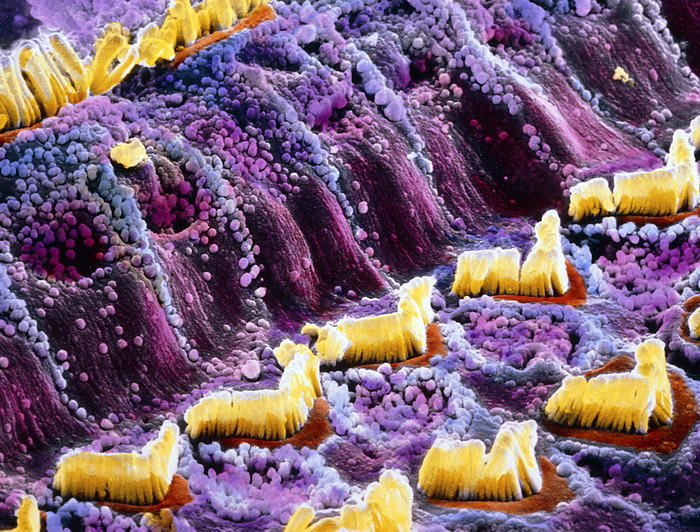False colour SEM of hair cells in the inner ear Inner ear. False colour scanning electron micrograph of hair cells  yellow  which are part of the Organ of Corti in the inner ear. They are divided into outer hair cells  v shaped  and inner hair cells  top left . Hair cells are immersed in a fluid called endolymph and react to the pressure of sound waves with an undulatory motion. This motion stimulates a nerve ending in each group of hair cells which carries a signal to various parts of the brain via the cochlear nerve. The two types of hair cells are divided by the pillar cells, seen here covered by microvilli  tiny spheres . Magnification: x1320 at 6x7cm size. x2205 at 4x5ins