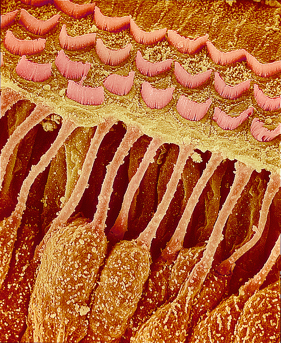 Sensory hair cells in ear, SEM Sensory hair cells in ear. Coloured scanning electron micrograph  SEM  of hair cells  brown  pink  in a healthy inner ear. The inner ear converts sound waves into nerve impulses by stimulation of stereocilia  pink, upper frame , projections at the ends of the hair cells. Waves entering the inner ear displace the fluid that surrounds the stereocilia, causing the stereocilia to bend. This bending causes the hair cells to release neurotransmitter chemicals, which generate nerve impulses that travel to the brain along the auditory nerve. The inner ear can transmit information about the loudness and pitch of a sound. Magnification: x1750 at 6x7cm size.