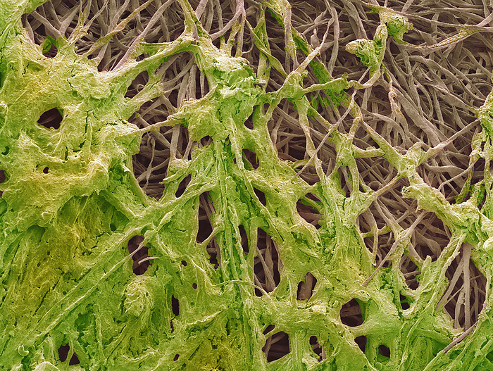 Ear wax, SEM Ear wax. Coloured scanning electron micrograph  SEM  of ear wax  green  collected on cotton bud fibres  brown . Ear wax forms in the ear canal, which runs between the outer ear and the ear drum. Ear wax, or cerumen, is produced by glands in the wall of the ear canal. It prevents the entry of bacteria and foreign objects that could damage the ear. Magnification: x40 when printed at 10 centimetres wide.