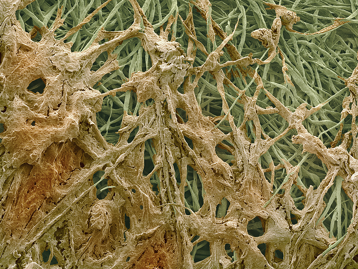 Ear wax, SEM Ear wax. Coloured scanning electron micrograph  SEM  of ear wax  brown  collected on cotton bud fibres  green . Ear wax forms in the ear canal, which runs between the outer ear and the ear drum. Ear wax, or cerumen, is produced by glands in the wall of the ear canal. It prevents the entry of bacteria and foreign objects that could damage the ear. Magnification: x40 when printed at 10 centimetres wide.