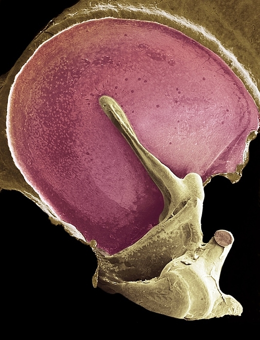 Eardrum, SEM Eardrum. Coloured scanning electron micrograph  SEM  of an eardrum  red . The eardrum, or tympanic membrane, is located in the middle ear. It joins the inner ear through three tiny bones called the ossicles  malleus, incus and stapes . The malleus  brown, centre  is attached to the inner eardrum. It articulates with the incus  lower right , which, in turn, links to the stapes  not seen . The middle ear transforms sound into vibrations in the fluid of the inner ear, which are then sent as nerve signals to the brain.