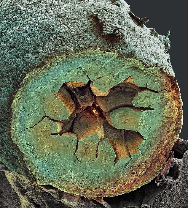Small intestine, SEM Small intestine. Coloured scanning electron micrograph  SEM  of a cross section through a foetal small intestine. The small intestine runs from the stomach to the large intestine. It is where digestion is completed and nutrients and water are absorbed into the blood. The interior  lumen  of the small intestine is lined with a highly folded surface. The folds, known as villi, project into the lumen increasing the surface area for absorption. Beneath the villi is the submucosal layer, which contains blood vessels. Beyond the submucosa is a layer of smooth muscle, which contracts and relaxes to move food along the intestine. Magnification: x45 when printed 10 centimetres wide.