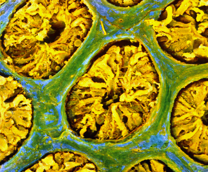False colour SEM of glandular wall of the colon False colour scanning electron micrograph  SEM  of a section through the glandular wall of the colon. The lattice like wall of the mucosa  green  contains many closely packed glands  yellow , each with a central canal leading to the surface. Two types of cells are found in these glands: columnar cells involved in water absorption  goblet cells which secrete mucous. It is difficult to distin  guish cell types here. In the colon, undigestable food becomes faeces with the absorption of excess water. While mucous is needed to protect the colon surface and to lubricate the faeces as it passes along. Magnification: x350 at 6x7cm size. Magnification: x540 at 4x5 inch size.