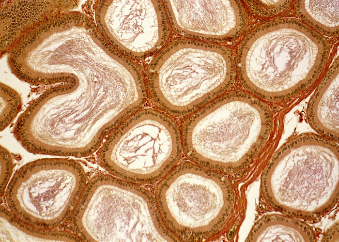 Human epididymis, light micrograph Human epididymis. Light micrograph of a section through a human epididymis, the tube connecting the testis to the vas deferens. The epididymis consists of a coiled duct about seven metres long. Its highly coiled shape makes it appear as multiple circles when sliced transversely. The lumen of the duct  white  is lined with pseudostratified epithelium  brown , which is made up of columnar cells with elongated nuclei and rounded basal cells with circular nuclei. The pale brown fibres extending into the lumen are stereocilia. The duct is surrounded by a layer of smooth muscle  red .