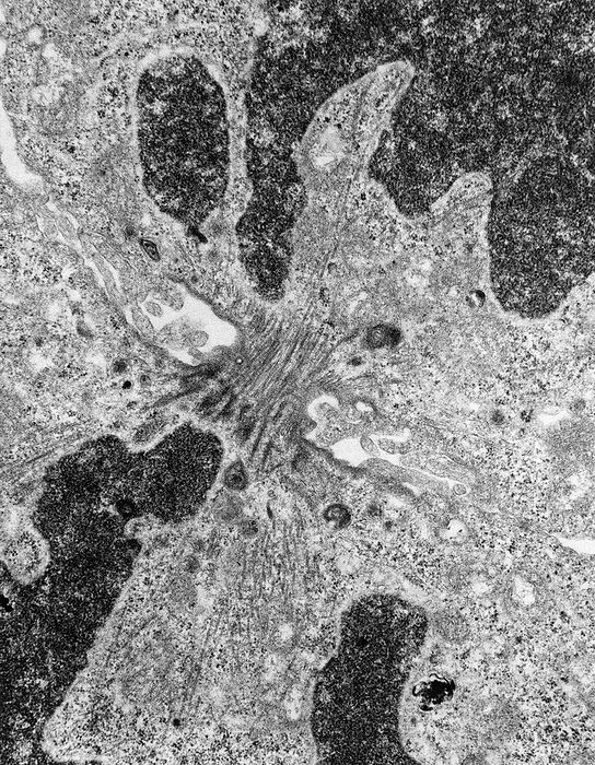 Transmission electron micrograph of cytokinesis Cell division. Transmission electron micrograph of the narrow bridge of cytoplasm  centre  between two separating cells. The dark areas contain chromosomes and will form the nuclei of the two daughter cells. Division of a cell s cytoplasm  cytokinesis  follows shortly after division of the nucleus  mitosis . A contractile ring of actin filaments gradually narrows the bridge between the two cells until it breaks the microtubule fibres of the spindle  parallel grey lines across bridge  and divides the cells. The spindle is involved in division of chromosomes during mitosis. This cell is from cultured human embryonic kidney tissue. Magnification x37,500 at 10x8 inch size.