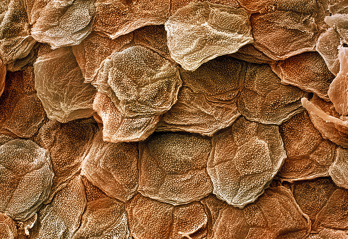 Human skin SEM Human skin. Coloured scanning electron micrograph  SEM  of the outermost layer of human skin, the epidermis. The outer layer of the epidermis  the stratum corneum  is a tough coating formed from overlapping layers of dead skin cells, which are continually sloughed off and replaced with cells from the dividing layers beneath. The skin is the largest organ in the body. It protects the body from injury and dehydration, and assists in the regulation of body temperature. Magnification: x650 at 6x7cm size.