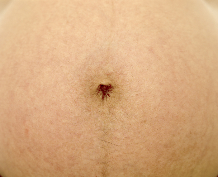 Navel Navel. Close up of a pregnant woman s navel or belly button, which is also known as the umbilicus. The faint brown line, running down from the navel, is called a linea nigra. It occurs mostly in darker skinned women during the second trimester of pregnancy. The line appears along a faint white line  linea alba  that most women posess but few are aware of.