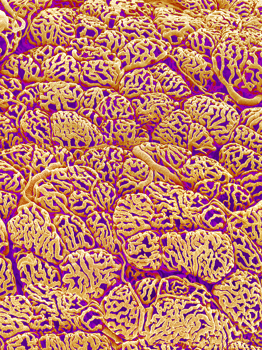 Thyroid gland capillaries, SEM Thyroid gland capillaries. Coloured scanning electron micrograph  SEM  of a resin cast of capillaries in the thyroid gland. The capillaries, the smallest blood vessels, are coiled around individual secretory areas known as lobes  rounded structures . Larger blood vessels bring blood to and from the capillaries. This network of vessels exchanges gases, hormones and nutrients with the gland tissue through the permeable capillary lwalls. The thyroid gland, part of the endocrine system, lies at the base of the neck. The hormones it secretes into the bloodstream control metabolism and growth. The cast was made by injecting resin into the blood vessels. The surrounding tissues were then chemically digested.