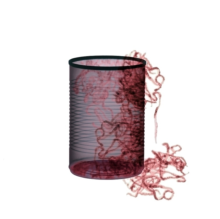 Earthworms in a can, X ray Earthworms  Lumbricus sp.  spilling out of a tin can, coloured X ray.