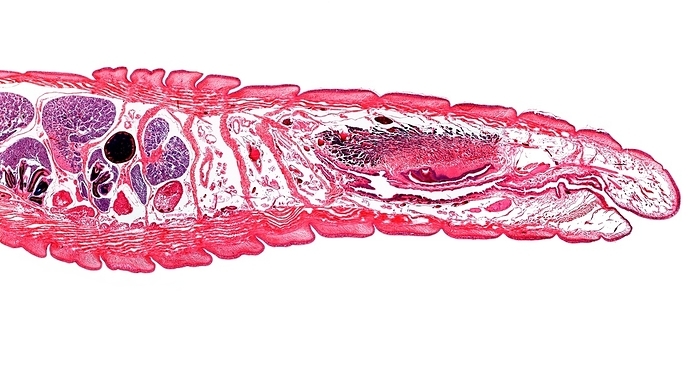 Earthworm, longitudinal section Earthworm. Light micrograph of a longitudinal section through the body of a round segmented earthworm  Lumbricus terrestris , showing the first 14 anterior segments. From right: the mouth  1 2 , buccal cavity  3 4 , thick pharynx  5 7 , oesophagus  pink rings, 8 14 . Segments 8 14 show the pseudohearts  dorsal pink rings . Segments 10 14 show the seminal vesicles producing sperm  solid purple circular areas . Segments 12 and 14 show the anterior and posterior seminal funnels  deep purple tubes , and the spermatheca  solid dark purple circle . Magnification: x14 when printed at 10 centimetres across.